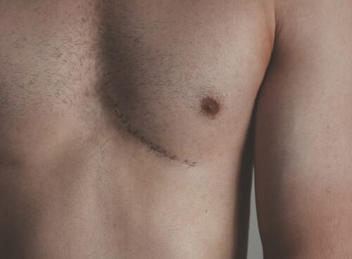 topless man standing near white wall